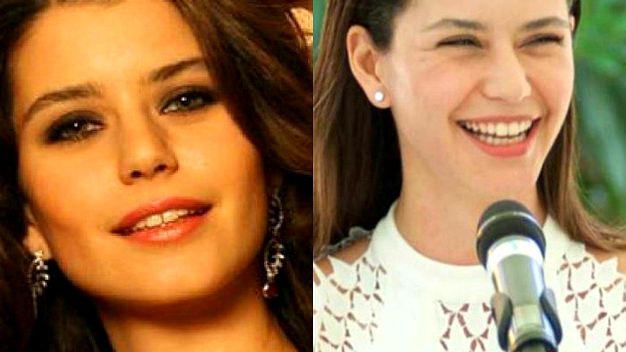 Beren Saat'in yaptırdığı estetik hayranlarını ikiye böldü